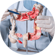 Cirurgia do Intestino