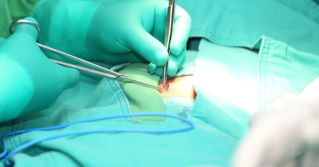 Tratamento e cirurgia de hérnia: quando operar?