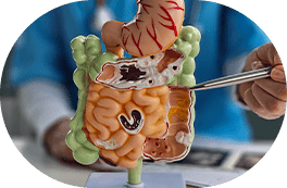 Miomas e Divertículos